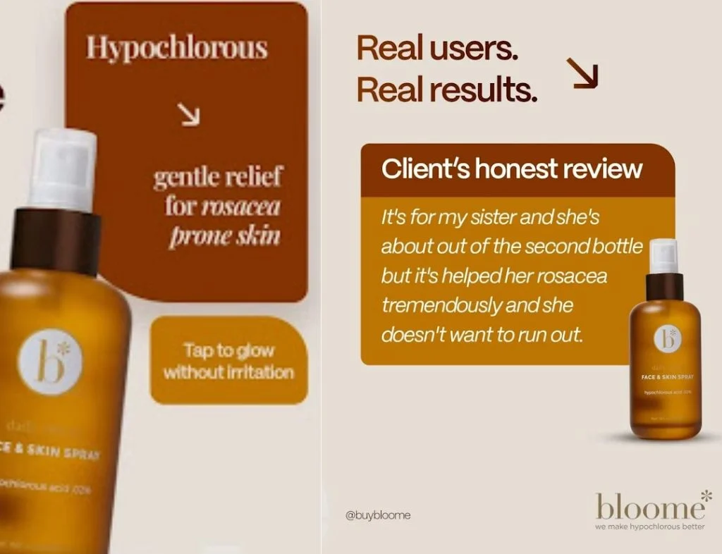 Say Goodbye to Redness with Our Calming Spray for Redness Relief